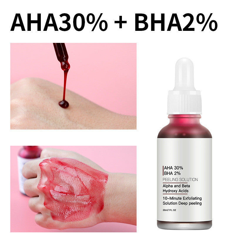 Removing Acne Marks Contracting And Tightening